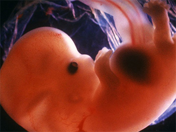 dezvoltarea-bebelusului-in-sarcina-7-saptamani