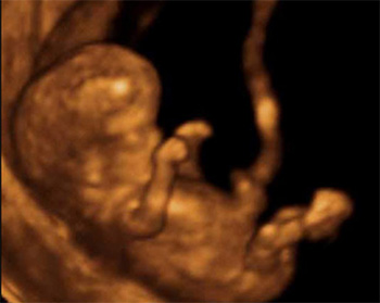 dezvoltarea-bebelusului-in-sarcina-12-saptamani-ecografie-3D