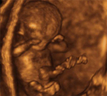 /files/dezvoltarea-bebelusului-in-sarcina-13-saptamani-ecografie-3D