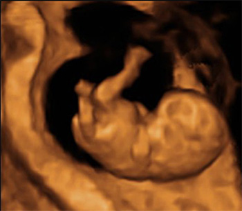 dezvoltarea-bebelusului-in-sarcina-8-saptamani-ecografie-3D