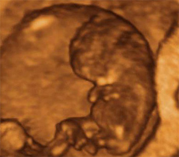 dezvoltarea-bebelusului-in-sarcina-9-saptamani