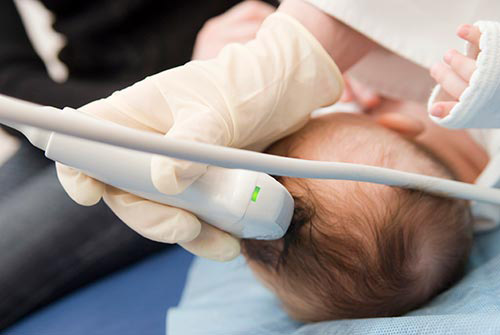Ecografia transfontanelară - un examen imagistic precis, ușor și neinvaziv pentru bebeluși