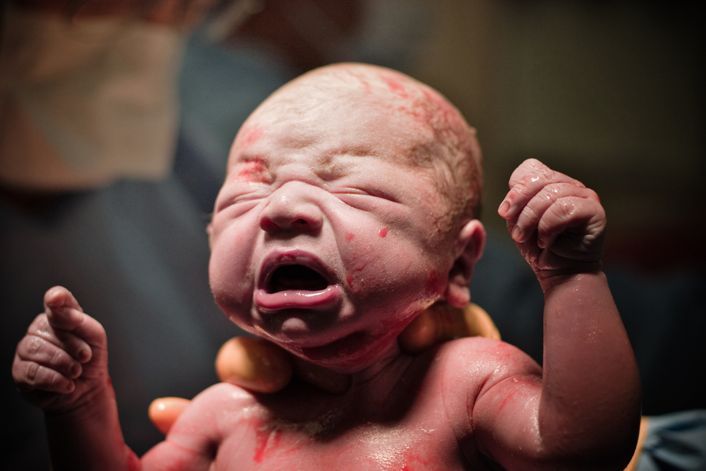 Cum arata nou-nascutul la nastere