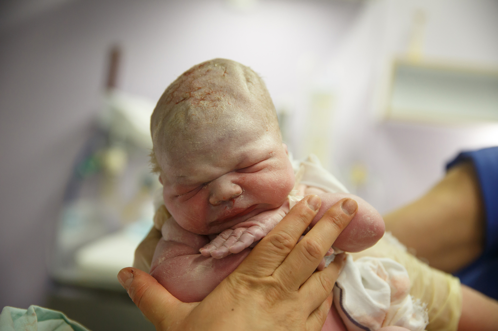 Sindromul de detresă respiratorie la nou-născut