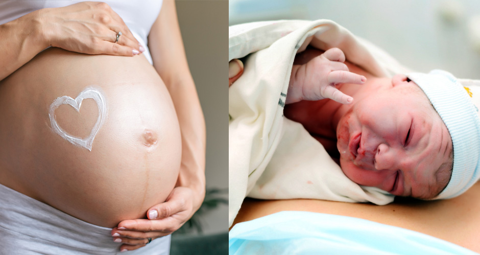 Varicoză de cezariană gravidă. Cauzele apariției varicelor în sarcină și cum pot fi combătute