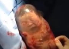 nasterea-bebelusului-cu-sacul-amniotic-intact.jpg