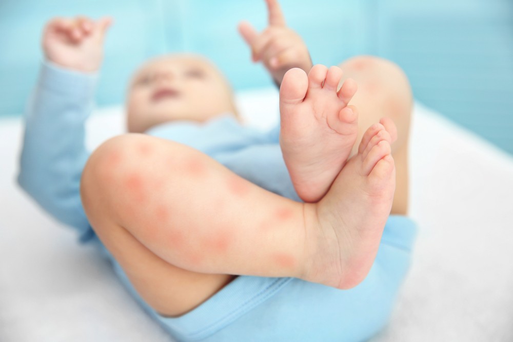 Colicile la bebeluși - Ce sunt, cum le recunoști și cum calmezi sugarul - Blog | Carrefour Romania