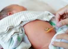 ingrijire bont ombilical nou nascut