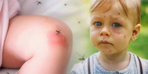 protectie-insecte-copii